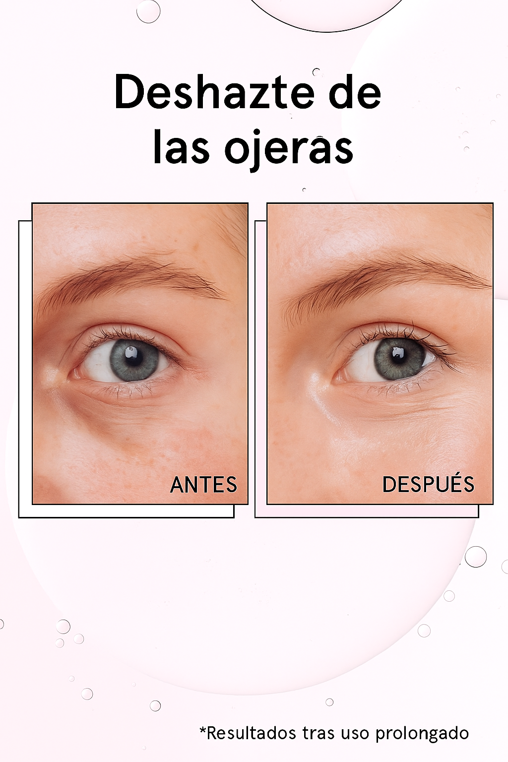 Parches de Colágeno COSRX: Elimina Ojeras, Líneas de Expresión y Patas de Gallina en Solo 10 Minutos