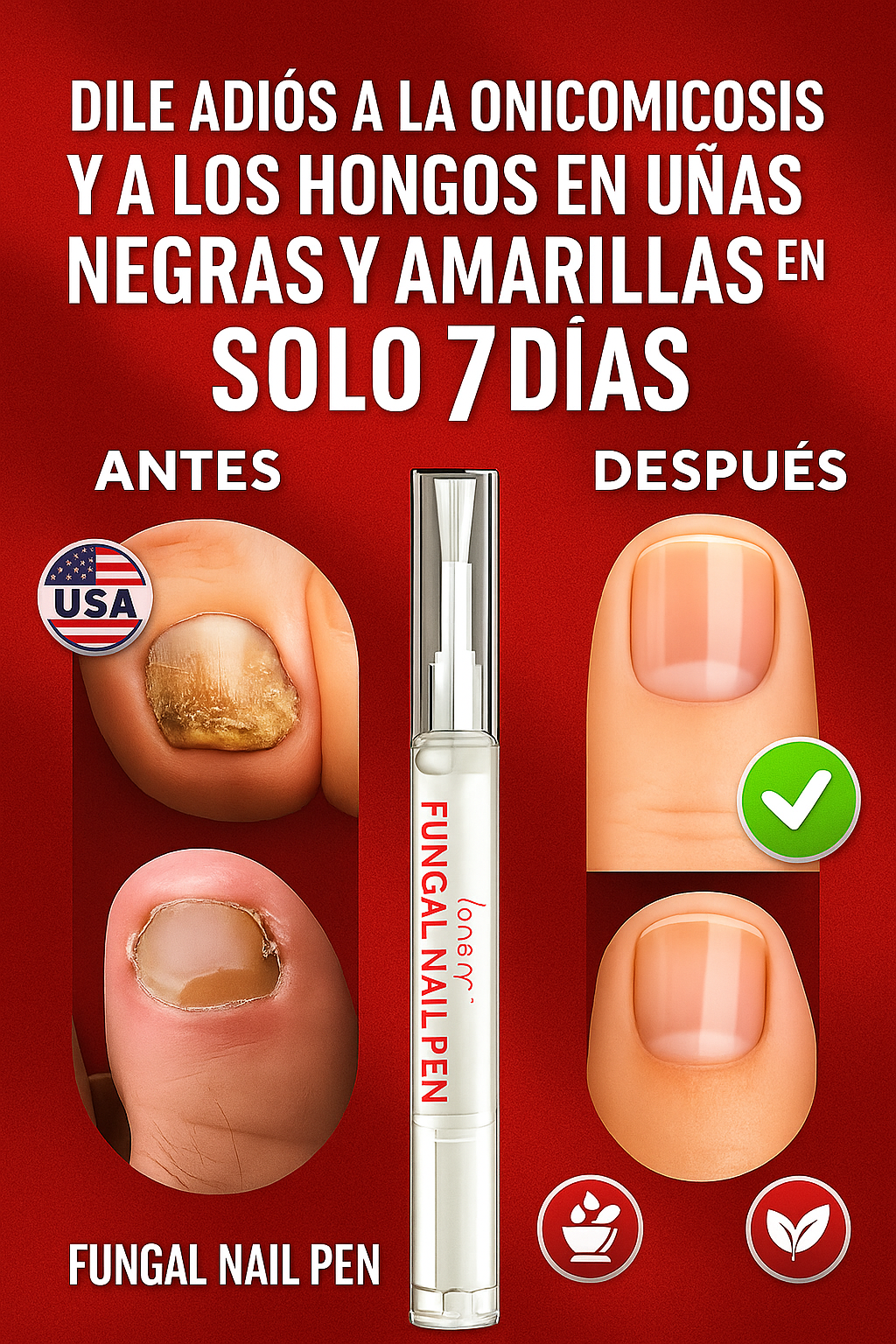 Lápiz Fungi Nai: Elimina hongos, onicomicosis y uñas negras o amarillas en solo 7 días
