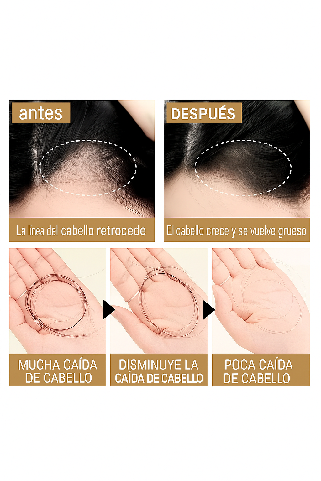 🧴 Shampoo REMIMPI Detén la caída y haz crecer tu cabello (2x1 HOY)