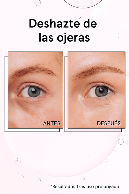 Parches de Colágeno COSRX: Elimina Ojeras, Líneas de Expresión y Patas de Gallina en Solo 10 Minutos