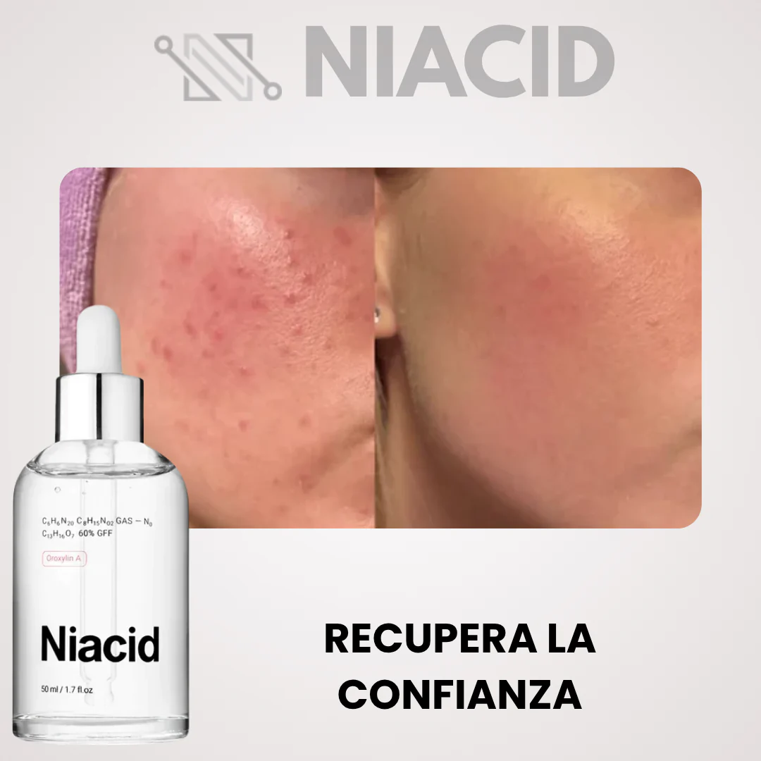 NIACID — dile adiós a las marcas de acné, cicatrices y manchas