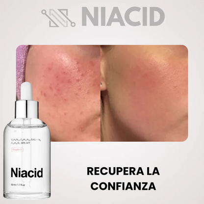 NIACID — dile adiós a las marcas de acné, cicatrices y manchas